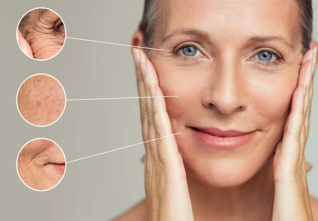 Mezoterapi Uygulaması